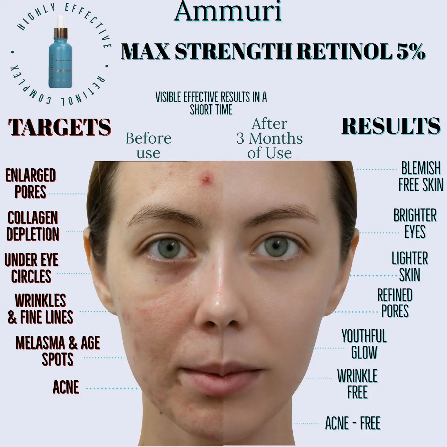 Ammuri-Skincare - Retinol Serum 5% (Max) Retinol High Strength For Face Ammuri Skincare